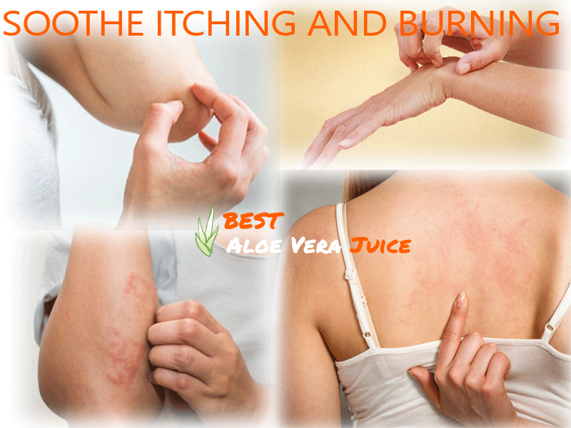Aloe Vera Gel For Soothe Itching and Burning