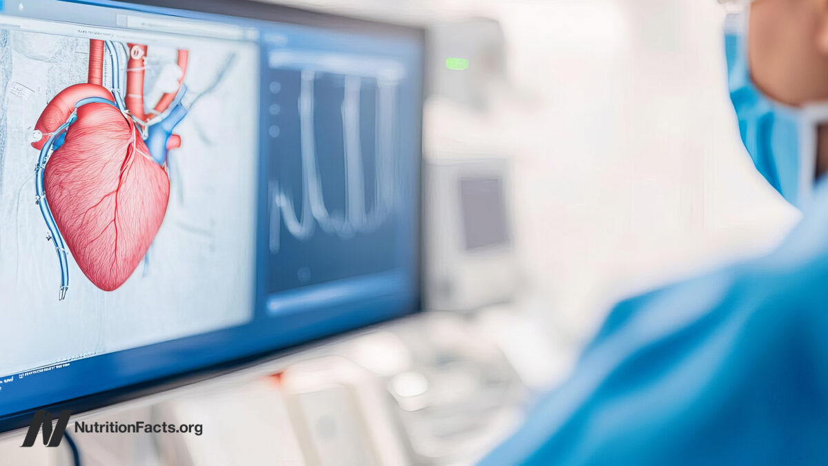 Cardiologists, Heart Stents, and Upcoding 