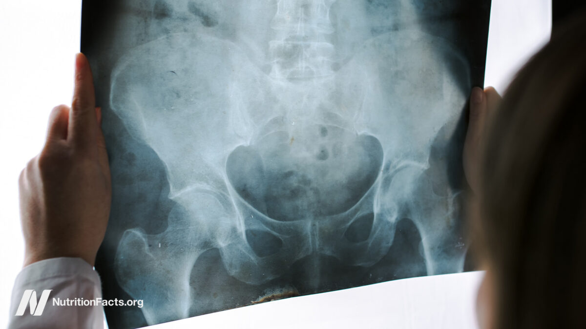 Pelvic Exams by Med Students on Anesthetized Women 